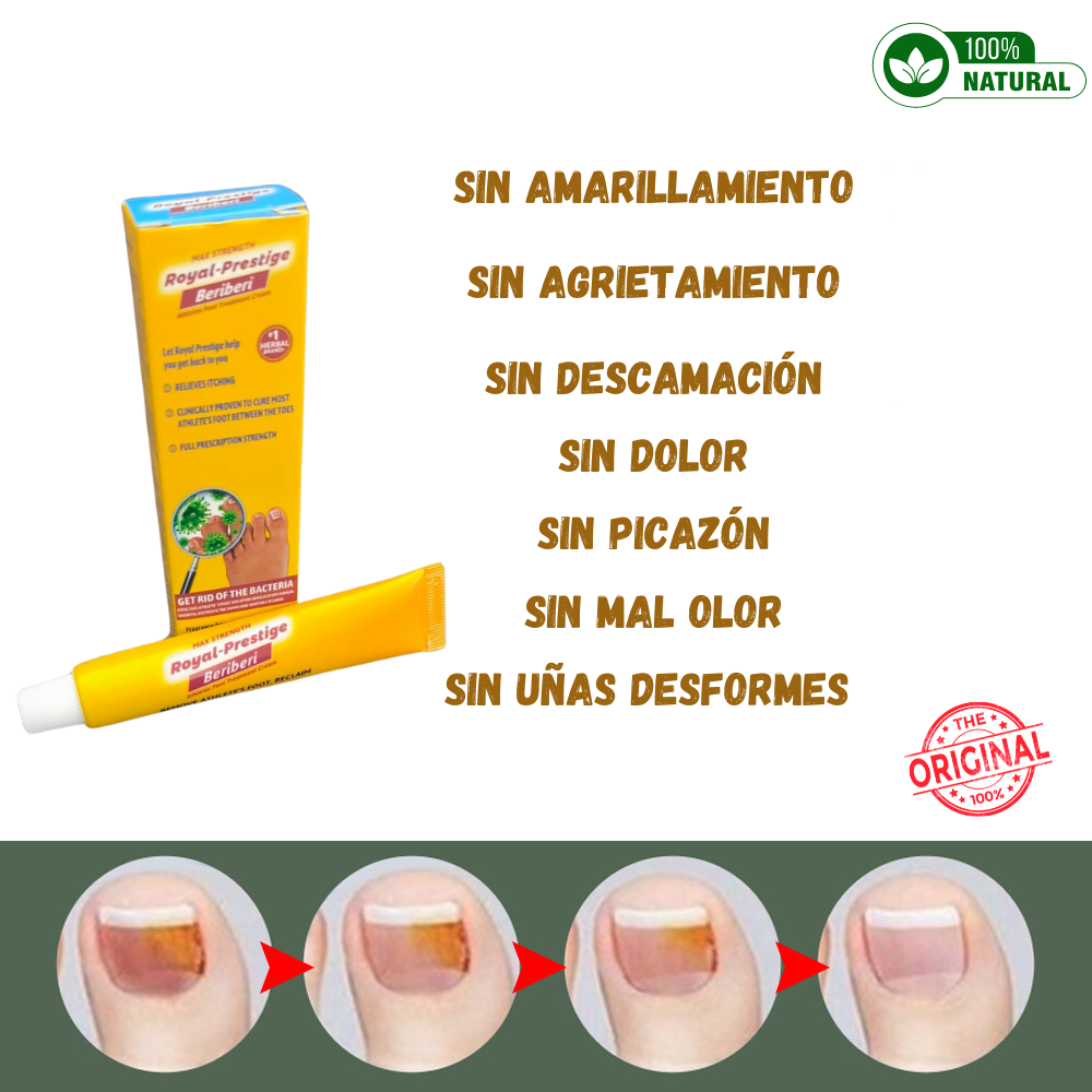 MAX STRENGTH - CREMA ELIMINADORA DE HONGOS Y PIE DE ATLETA BERIBERI🦠