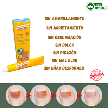 MAX STRENGTH - CREMA ELIMINADORA DE HONGOS Y PIE DE ATLETA BERIBERI🦠